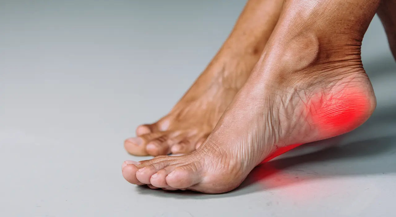 En uttrampad hälkudde uppstår när fettlagret under hälen