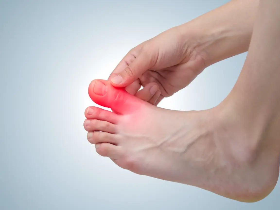 Hallux rigidus är en degenerativ sjukdom